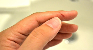 Kağıt kesiğinin dayanılmaz acısının sırrı ortaya çıktı: Meğer bu yüzden canımızı çok yakıyor