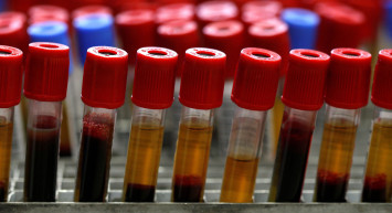 Kan grubunuz sizin kişilik özellikleriniz hakkında ipuçları veriyor!