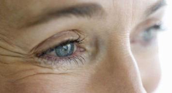 Kaz ayakları nasıl geçer? Kaz ayaklarını yok edecek 4 doğal yöntem... 