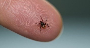 Kene ısırması ilk yardım ve tedavisi nedir? Kene ısırdığında neler yapılmalı?