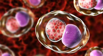 Klamidya nedir, belirtileri nelerdir, tedavisi nasıl yapılır? Cinsel yolla bulaşan klamidyadan korunmanın 5 etkili yolu