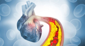 Kolesterol nedir, belirtileri nelerdir, nasıl düşürülür? Kolesterole iyi gelen besinler