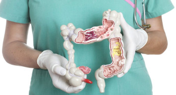 Kolon Kanseri Nedir, Belirtileri Nelerdir, Nasıl Tedavi Edilir?