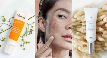 Korkulu rüya olan güneş lekelerine son! İnatçı güneş lekeleri için tavsiye edilen 10 krem