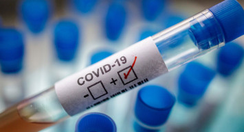 Koronavirüs haftalık tablosunda son durum? Sağlık Bakanlığı verileri açıkladı: Vaka ve ölümler hızla artıyor!