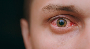 Koronavirüsün Yeni Belirtisi Gözde Meydana Geliyor!