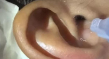 Kulak ağrısıyla gittiği hastanede şaşkına döndü! Kimse beklemiyordu!