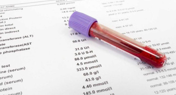 Lipaz enzimi normal değeri kaç olmalı? Lipaz değeri yüksekliği ve düşüklüğü tedavileri