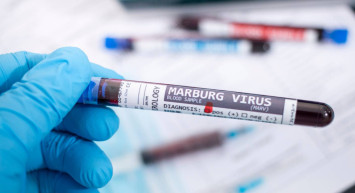 Marburg virüsü nedir, ölümcül mü? Marburg virüsü belirtileri neler, tedavisi var mı? Dünyanın en ölümcül virüsü yeniden ortaya çıktı