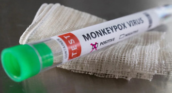 Maymun çiçeği salgını yayılıyor: DSÖ, küresel acil durum ilan etti