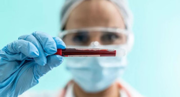 MCHC kan tahlili nedir, neden istenir? MCHC hangi durumlarda artar? MCHC yüksekliği ve düşüklüğünün etkileri