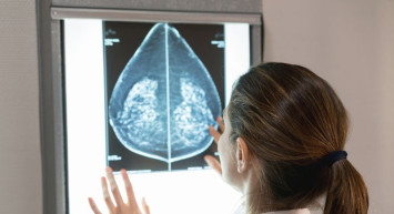 Meme Kanserinde Doğru Bilinen Yanlışlar