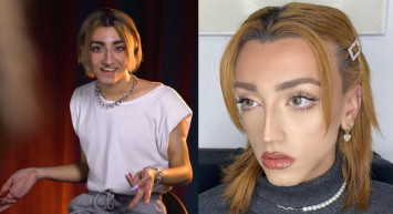 Mika Can Raun aslen nereli? Mika Türk mü? Mika Raun estetik olmadan önceki hali? Estetik oldu mu?