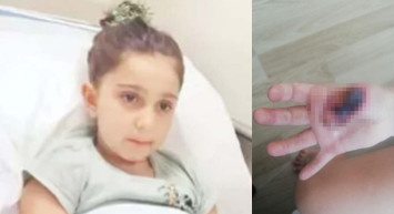 MR çekilen küçük kız yandı! Soluğu adliyede aldılar