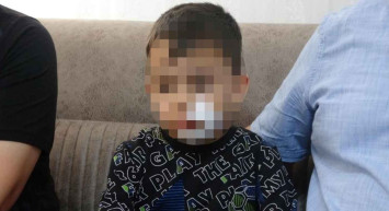 Niğde’de başıboş köpek terörü: 6 yaşındaki anaokulu öğrencisine 11 dikiş atıldı!