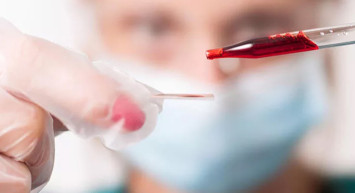 PDW nedir, PDW Yüksekliği Ne Anlama Gelir?