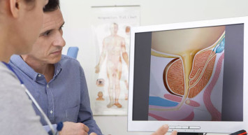 Prostat Kanseri Nedir, Belirtileri Nelerdir?