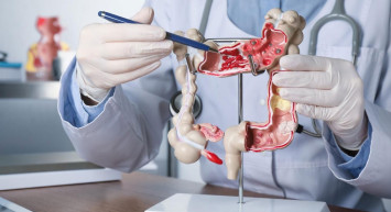 Rektum kanseri nedir, Belirtileri nelerdir?