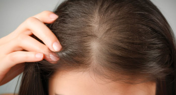 Saç derisindeki kaşıntı canınıza tak mı etti? Kurtulma yollarını size sunuyoruz!