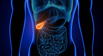 Safra kesesi kanseri ölümcül müdür? Safra kesesi kanseri tedavi aşamaları