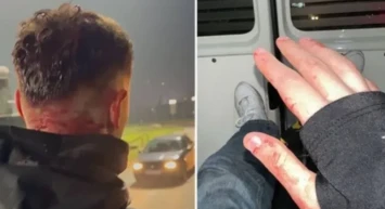 Saraybosna'da Trabzonlu taraftarlara saldırı