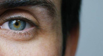 Sarı Nokta Hastalığı Nedir?