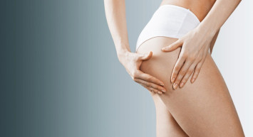 Selülit Oluşumunu Önlemek İçin Süper Tavsiye