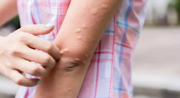 Sivrisinek ısırığından 11 kişi hayatını kaybetti: O bölge için alarm verildi