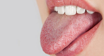 Sjögren sendromu nedir, belirtileri nelerdir? Tedavi edilmediğinde körlüğe yol açan sjögren sendromunun 8 belirtisi