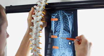 Skolyoz (Omurga Eğriliği) Belirtileri Nelerdir?