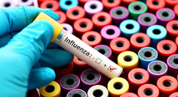 Son günlerin en yaygın hastalığı: Uzmanlardan influenza uyarısı! İşte influenzadan korunma yolları