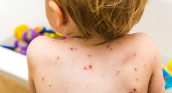 Su Çiçeği Nasıl Olur? 