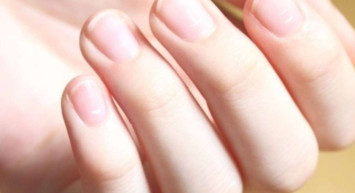 Tırnaklardaki beyaz leke neden olur? Tırnaklarda beyaz leke için çözüm önerileri