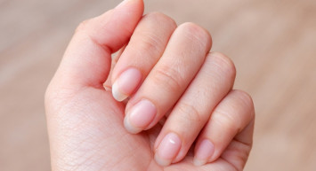 Tırnakta beyaz lekeler neden olur, hangi hastalığın habercisi? Lökoniki böbrek yetmezliğinin habercisi