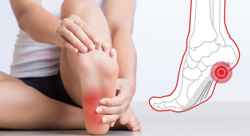 Topuk dikenine ne iyi gelir? Topuk dikeninin doğal ilacı bitkisel yöntemlerde saklı