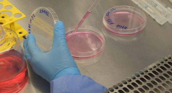 Türk bilim insanlarının büyük keşfi: Kanserde yeni bir mekanizma