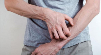 Uyuz Bulaşıcı mıdır?