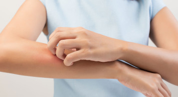 Uyuz hastalığı nedir, belirtileri neler? Uyuz hastalığında döküntü ve kaşıntıları geçirmek için öneriler