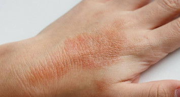 Vakalar her geçen gün artıyor: 15 dakika bile yetiyor