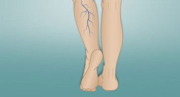 Varislerde yapay zeka destekli konforlu tedavi yöntemi!