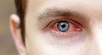 Vitrektomi Ameliyatı Nedir?