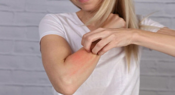 Vücudundaki kaşıntıları takip etti! İpin ucu ölümcül hastalığa dayandı!