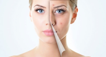 Yara izleri için en iyi krem hangisi? Yara iyileştirici ve iz bırakmayan krem önerileri