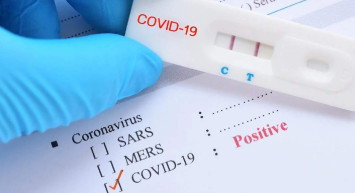 Yerli Ve Milli Kovid-19 Tanı Kiti,30 Dakikada Sonuç Veriyor! Kısa sürede sonuç veren bu test güvenilir mi?