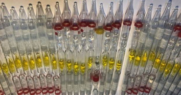 230 Tüp Kobra Yılanı Zehri Bulundu