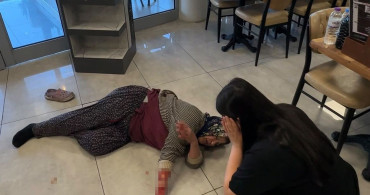 Afyonkarahisar'da köpek saldırısı: kadının kolu koptu