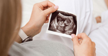 Anensefali Nedir? Anensefali Belirtileri Nelerdir?