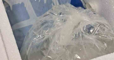 Başıboş Köpeklerin Saldırısı: Adamın Başparmağı Koptu