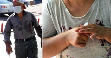 Kurban Bayramı'nın İlk Günü Yaralı Sayısı Rekor Kırdı!