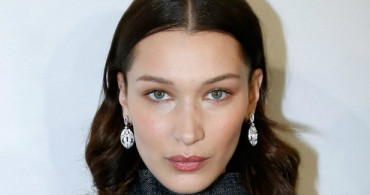 Bella Hadid’in Yüz Şişkinliğine Çözümü